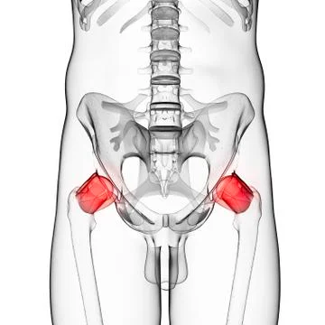 Human hip pain, artwork Stock Illustration