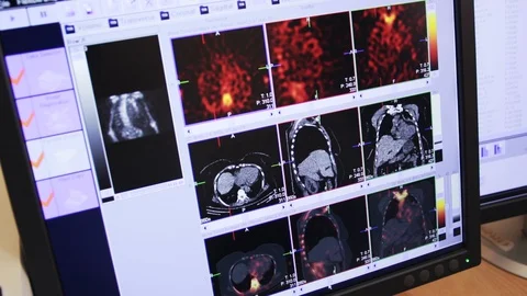 Human internal display Stock Footage 128748630