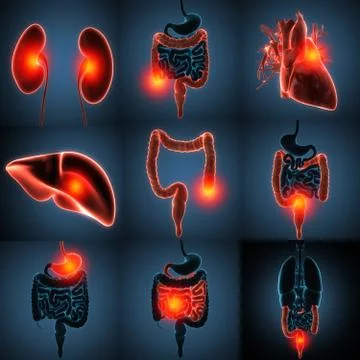 Human internal organs disease set 3d rendering Stock Illustration