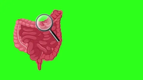 Human intestines examined by a small camera on a green screen background. Stock Footage 333943306