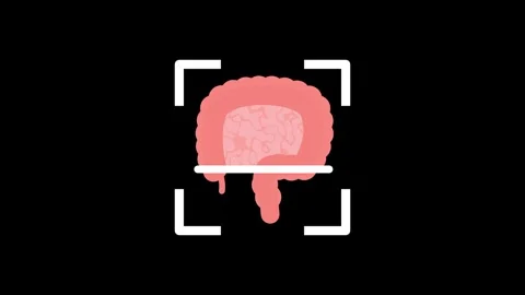 Human Intestines Stock Footage 334178810