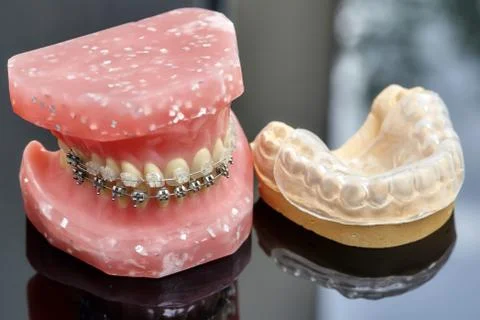 Human jaw or teeth model with metal wired dental braces Stock Photos