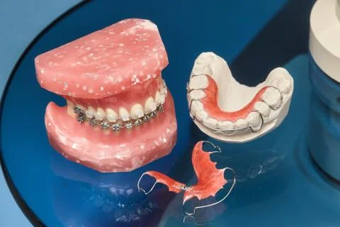 Human jaw or teeth model with metal wired dental braces Stock Photos