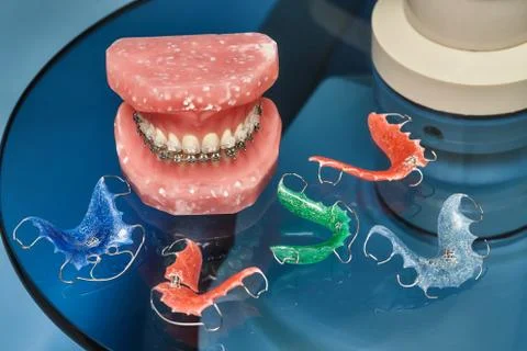 Human jaw or teeth model with metal wired dental braces Stock Photos