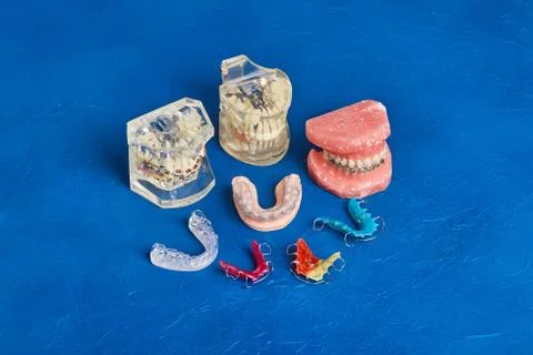 Human jaw or teeth model with metal wired dental braces Stock Photos
