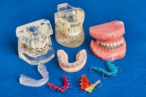 Human jaw or teeth model with metal wired dental braces Stock Photos