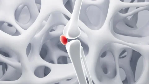 Human joint bones and porous skeletal framework background, 3d rendering. Stock Footage 314821743