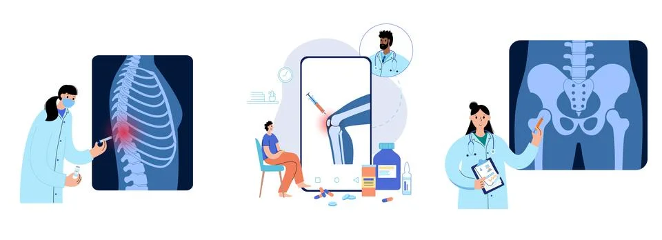 Human joint injection Illustrazione stock