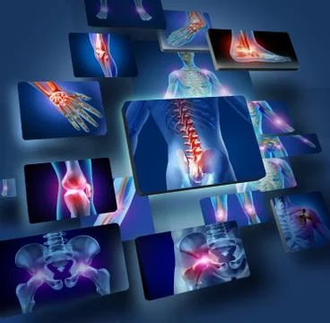 Human joints concept Stock Illustration