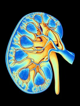 Human kidney, cut-away computer artwork Illustrazione stock