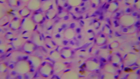 The human kidney. Microanatomy. Cross section of kidney. 1000x magnification Stock Footage 265179557