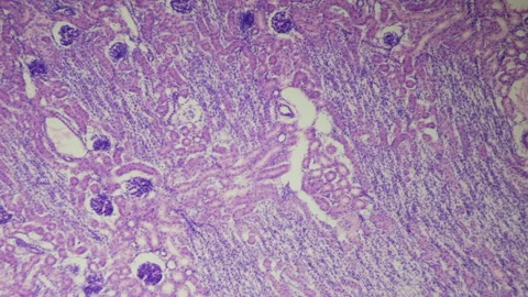 The human kidney. Microanatomy. Transverse section of a mammalian kidney. 100x Stock Footage 265179716