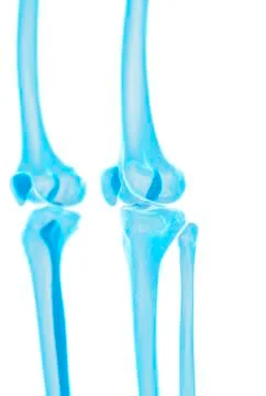 Human knee bones Stock Illustration