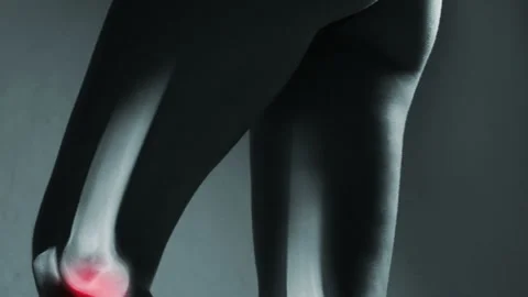 Human knee joint and leg in x-ray, on gray background Stock Footage 89673545