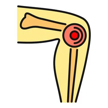 Human knee joint experiencing pain and inflammation Stockillustratie