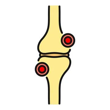 Human knee joint showing inflammation and pain Stock Illustration