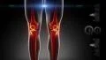 Human knee medicla scan HD Footage