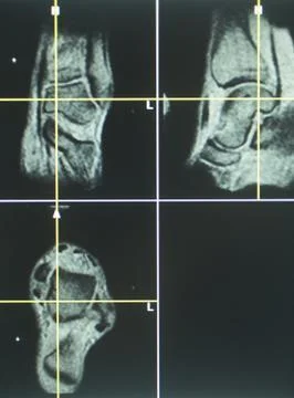 Human knee open mri ct scan Stock Photos