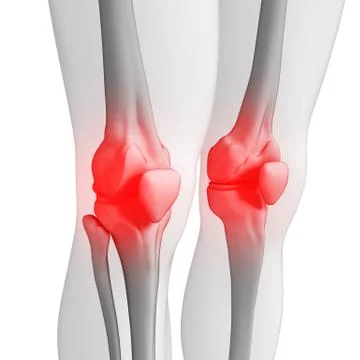 Human knee pain artwork Illustrazione stock