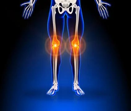 Human knee pain 스톡 일러스트