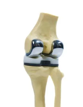 Human knee replacement Stock Photos