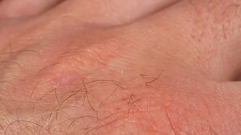 Human knuckles macro. Human skin texture. Male skin. 4K Stock Footage 126120806