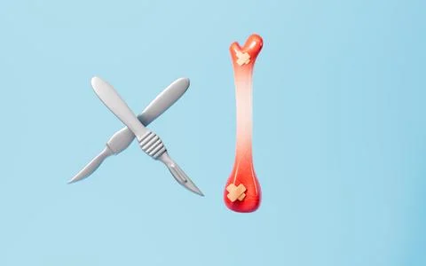 Human leg bone and surgical tools, 3d rendering. Stock Illustration