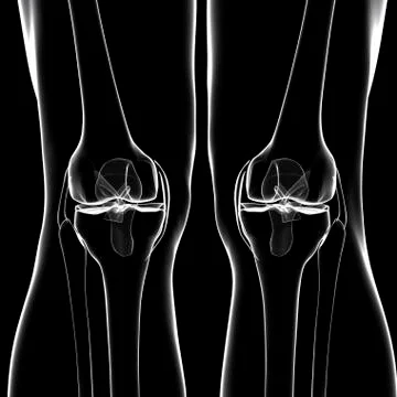Human leg bones, artwork Stock Illustration