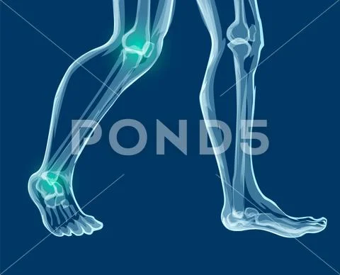 Human leg bones, x-rays. Mecial vector illustration. Ilustração Stock