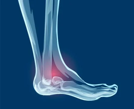 Human leg bones, x-rays. Mecial vector illustration. Stock Illustration