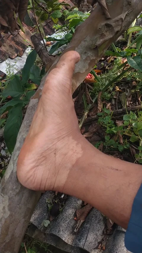 Human Leg with Unique Skin Marking – Close-Up Half-Leg Footage Stock Footage 306826739