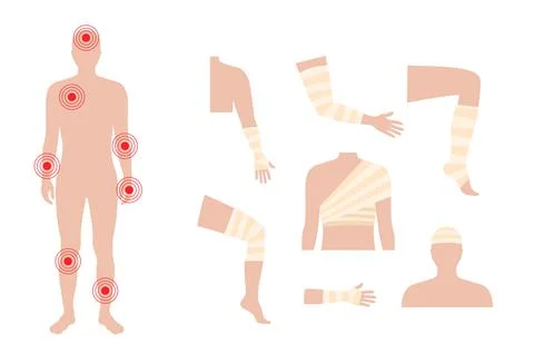 Human limbs trauma Stock Illustration