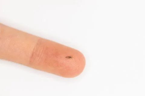 A human louse on a finger when lice was discovered in a child's hair Stock Photos