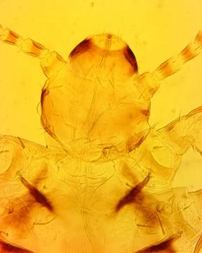 Human louse (Pediculus humanus) head - permanent slide plate under high magni Stock Photos