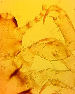 Human louse (Pediculus humanus) head - permanent slide plate under high magni Stock Photos