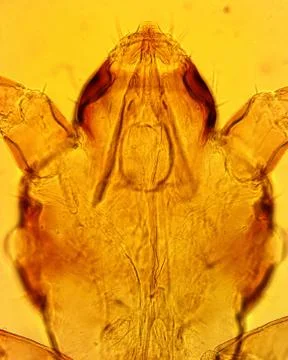 Human louse (Pediculus humanus) head - permanent slide plate under high magni Foto stock