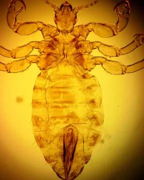 Human louse (Pediculus humanus) - permanent slide plate under high magnificat Foto stock