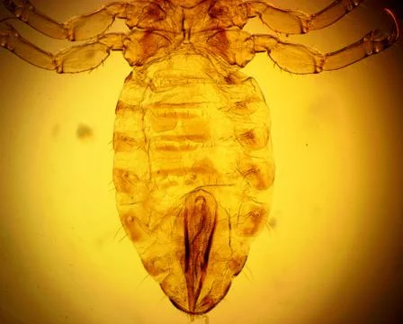 Human louse (Pediculus humanus) - permanent slide plate under high magnificat Foto stock