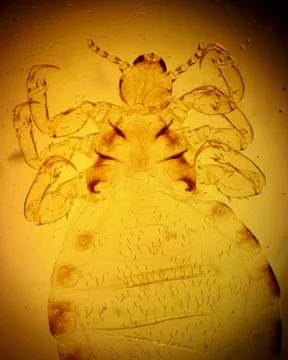 Human louse (Pediculus humanus) - permanent slide plate under high magnificat Stock Photos
