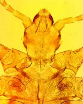 Human louse (Pediculus humanus) - permanent slide plate under high magnificat Foto stock