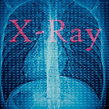 Human lumbar bone Foto stock