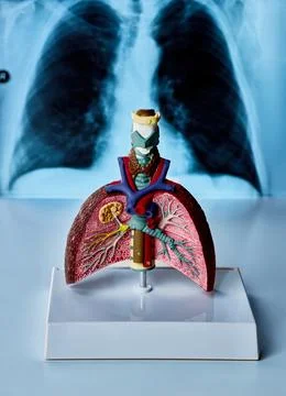 Human lung anatomy model displayed with chest X-ray in medical office for r.. Stock Photos