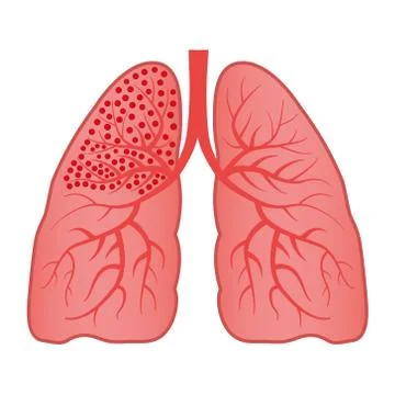 Human Lung Vector Illustration on Isolated White Background Stock Illustration