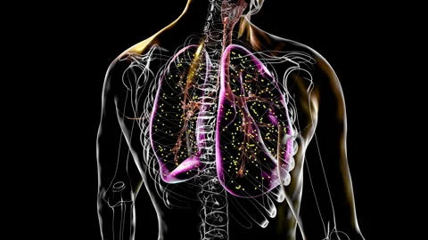 Human lungs affected by miliary tuberculosis, tb, animation Stock Footage 278399540