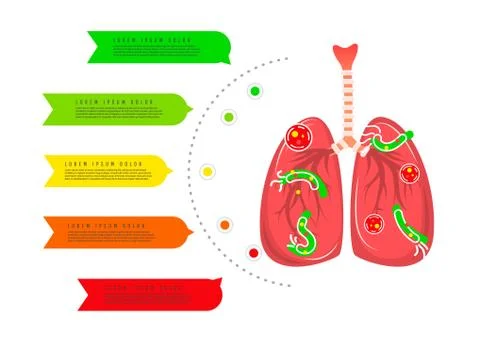 Human lungs are hit by germs and parasites, lung cancer infographics isolated on Stock Illustration