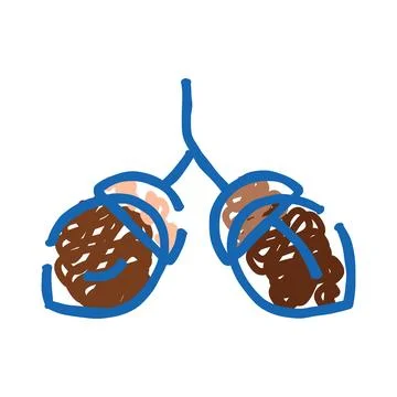 Human lungs filled with pine cones illustration Stockillustratie