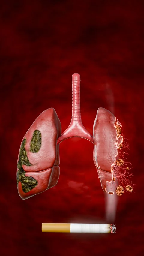 cigarette tar in lungs Smoking - The respiratory system humans  WJEC - GCSE Biology (Single Science) Revision - WJEC Before you start #smoking, think