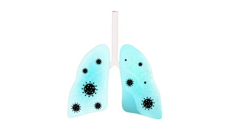 Human lungs with viruses Vidéo 130800249