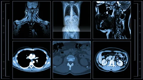 Human MRI Stock Footage 141958651