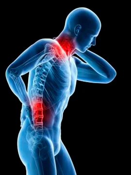 Human neck and back pain, artwork イラスト素材